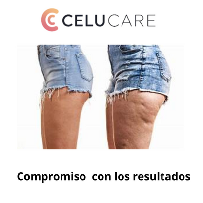 Nuevo masajeador anticelulítico Celucare®